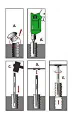 Projahn 5 Parça Klavuz Seti